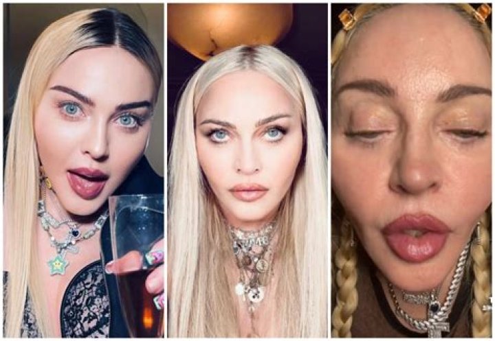 Filter or Filler? Madonna Looks Unrecognizable in a Recent TikTok: ‘This is Completely Unsettling’